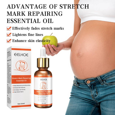 Smooth Belly Care: Stretch Marks Removal Treatment Health, Beauty & Hair